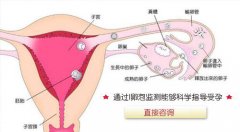 卵泡监测多少钱