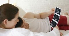 孕妇做b超需要空腹吗
